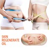 125ml Stretch Mark Oil & Scar Treatment, Skin Regeneration Oil