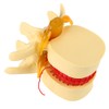 1:1.5 Anatomical Medical Human Spine Lumbar Disc Herniation Demonstration Model