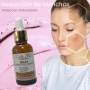 Serum Bellapiel Despigmentanteacidohialuronico Azelaico 30ml