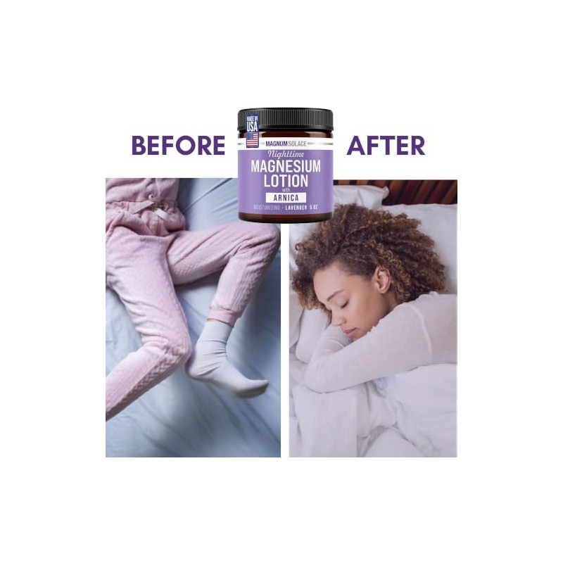 Nighttime Magnesium Lotion with Arnica Soothing Relief Relaxation, Highly Concentrated