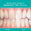 Opalescence Opalescence 35% PF Teeth (4 Syringes) Whitening Refill Kit