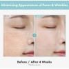 TOSOWOONG SOS Tightening PORE Clinic 1.76 oz