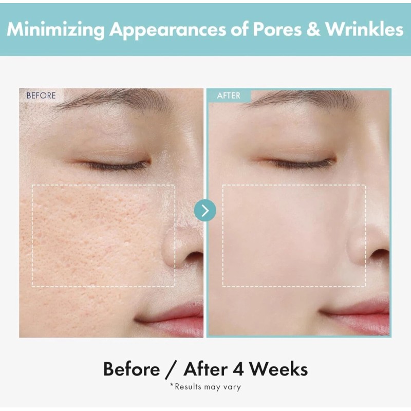 TOSOWOONG SOS Tightening PORE Clinic 1.76 oz