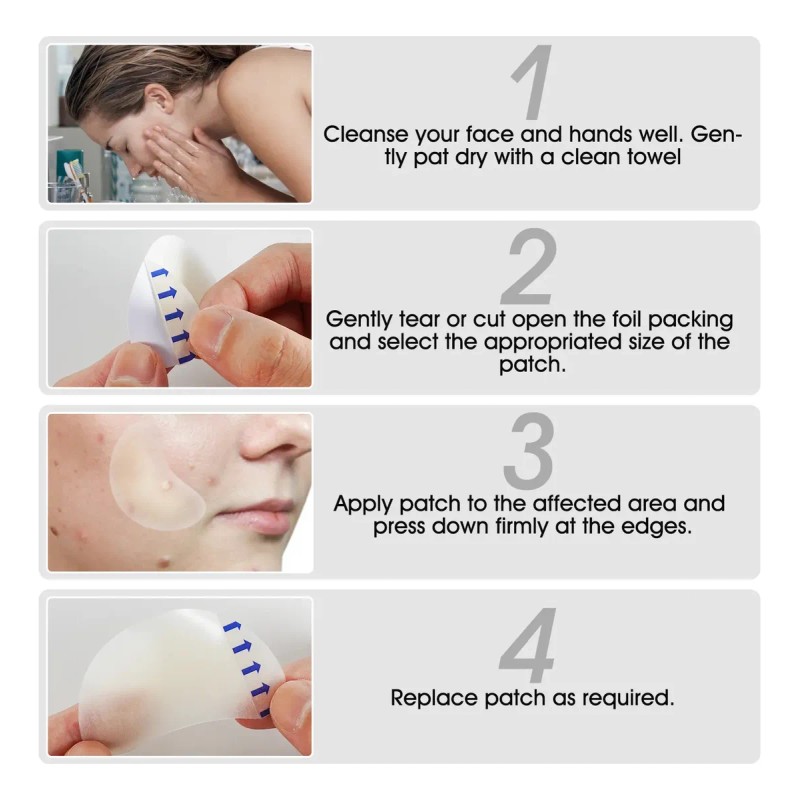 Parches Adesivos Combate El Acne Con Tecnologia Hodrocoloide Todo Tipo