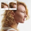 Nioxin Kits Sistema Engrosamiento Cuero Cabelludo Cabello Natural Teñido Dañado