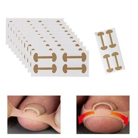 Toenail Care Set: 40P Care Bands (10 Sheets) for Ingrown Toenail Correction Toenail Care Band 10-Sheet Set