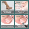Toenail Corrector 52 Pieces Ingrown Toenails Set Toenail Correction Patch