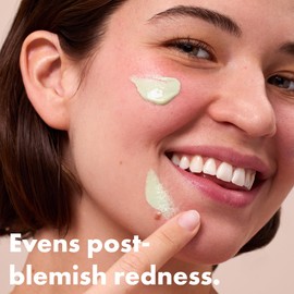 Hero Cosmetics Rescue Balm Post-Blemish Recovery Cream & Red Colour Corrector, Reduces Redness and Long-Lasting Hydration to Improve Skin Look, Dermatologist-Tested, Suitable for Sensitive Skin, 15 ml