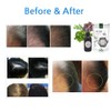 Hair Restoration / 100% Natural Herbal Treatment Spray for helping