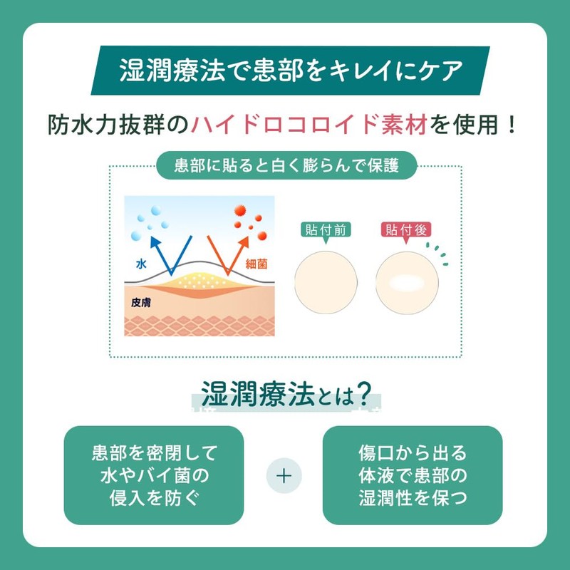 KIWAMI ByeByeNIKIBI ニキビパッチ 56枚入り 一般医療機器 CICA配合 湿潤療法 ハイドロコロイド素材 ティーツリー UVカット