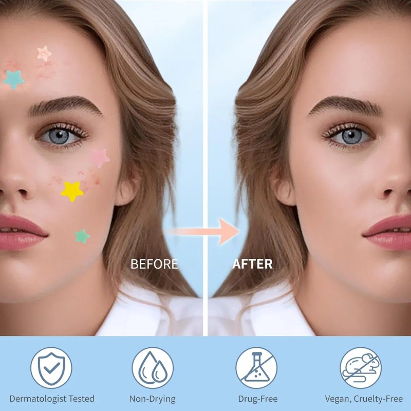 🔥 240pzs mascarillas parches para el acne espinillas granos Vitaminas