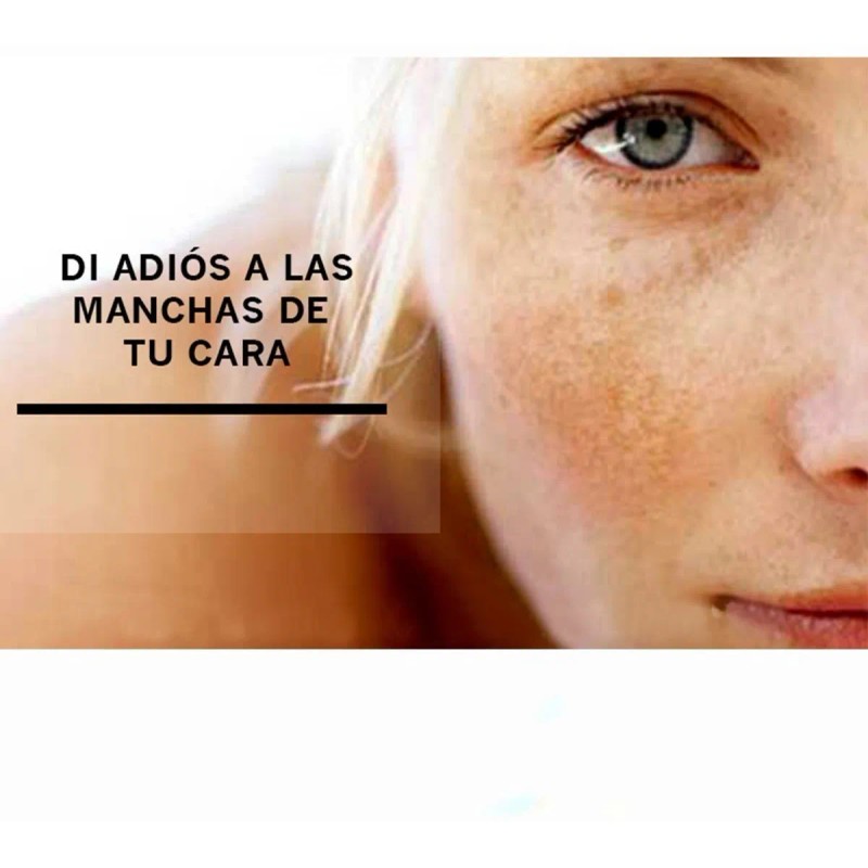 Tratamiento Despigmentante Antimanchas Antiedad Dia Y Noche