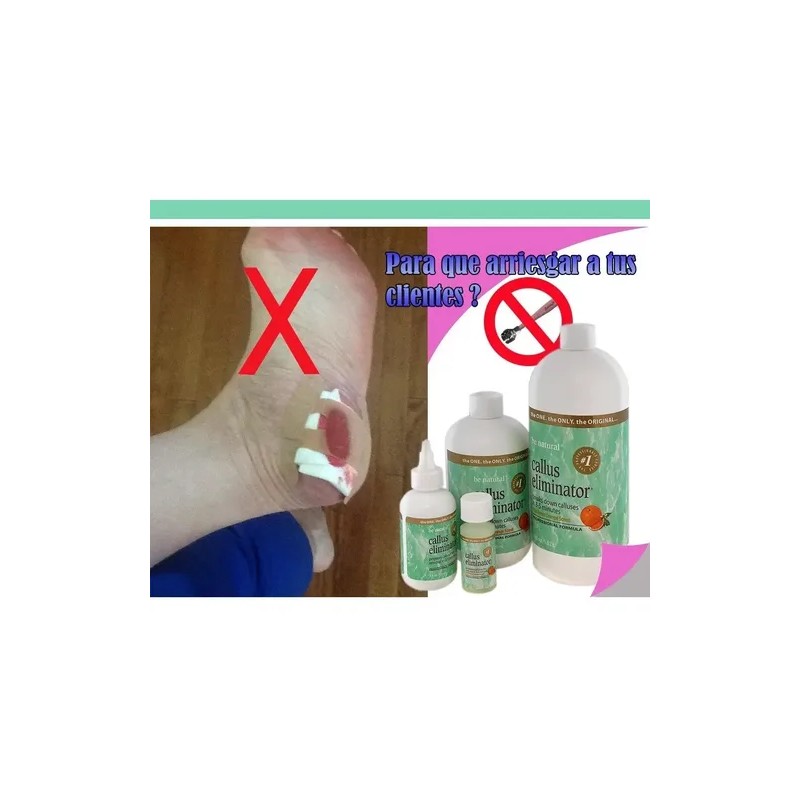 Eliminador De Callos / Callus Eliminator Be Natural 18 Oz
