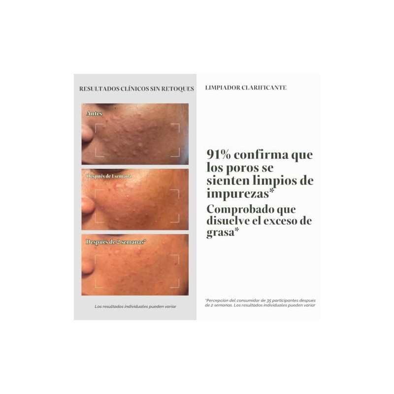 Murad Clarifying Cleanser | Limpiador Facial Profundo con Ácido Salicílico
