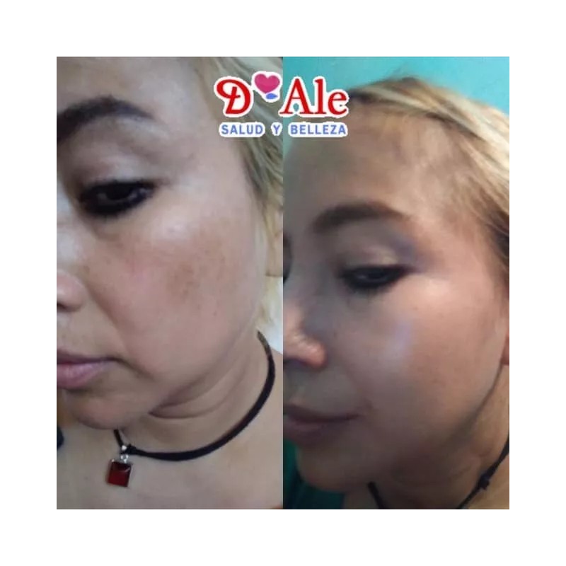 D'Ale 2 Cremas Facial Regeneradora Células Madre, Hidratante, Fps