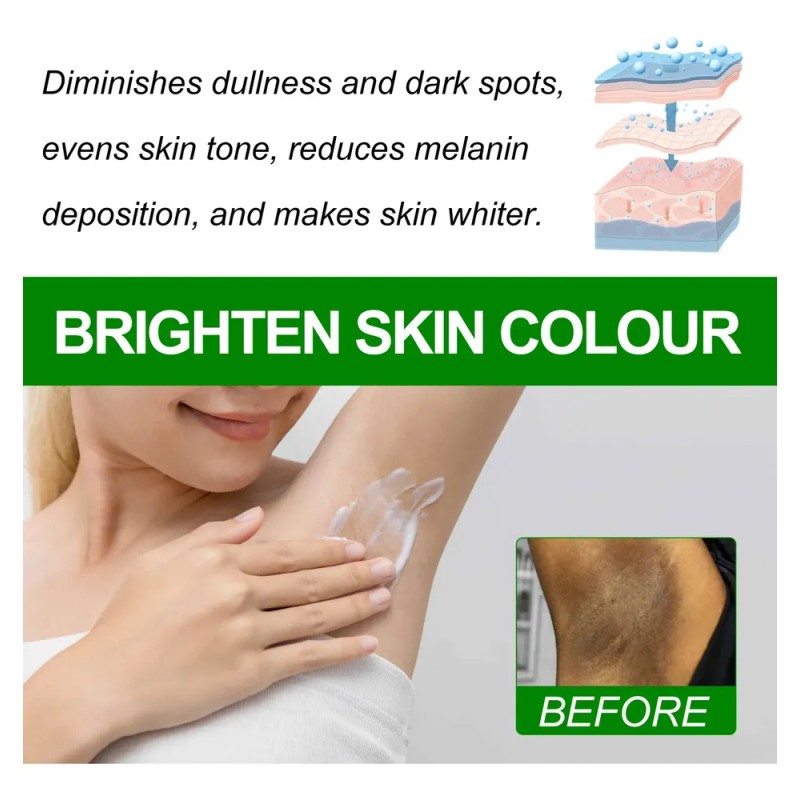 Crema Corporal Aclaradora De Piel Eelhoe Para Codos Y Axilas