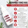 Fungi Nail ToenailTreatment,Gentle Formula,Effectively lmproves Nails for a More Beautiful