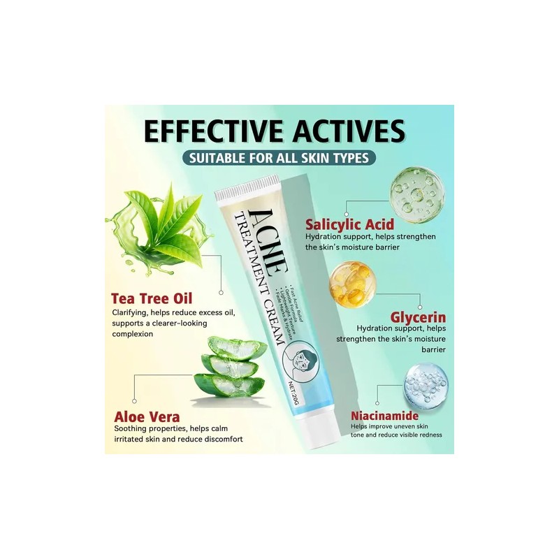Tratamiento Para El Acné Facial, Crema Antiacné, Crema Para
