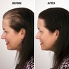 Infinity Hair Fibers, Keratin Hair Loss Concealer, Women and Men,