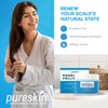 Scalp Cream for Psoriasis Folliculitis, Helps Relieve Itching Flaking, with