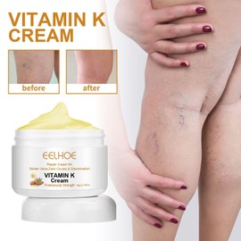 PIKAXIS 2PCS Varicose Veins Miracle Cream, Vitamin K Cream, K Miracle Cream, Vitamin K Cream Suitable for Legs and Face, Suitable for All Skin Types, Deeply Nourishing and Moisturizing