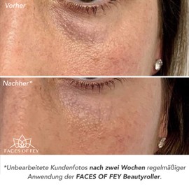 Rose Quartz Roller FACES OF FEY - Premium Real Rose Quartz Face Roller - High Quality Beauty Roller for Face Massage