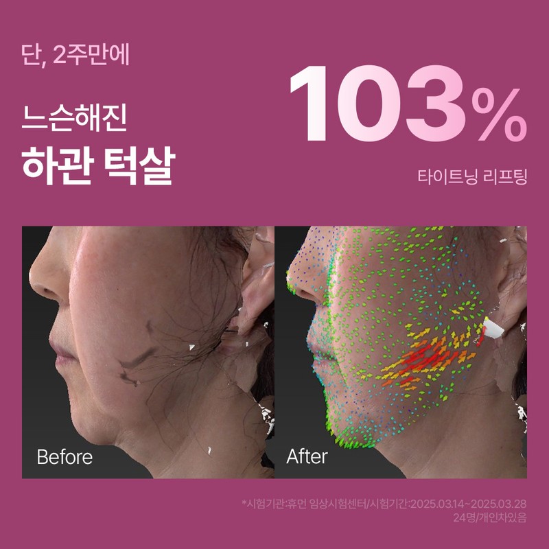The Medi Doctor Double chin guasha massage / Shrink cream