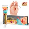 Scar Cream for Pressure Points, Soothing Cream for Pressure Points,