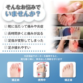 足指グッズ 親指ストレッチャー 装着簡単 自宅用 洗える 防臭 男女兼用 左右兼用(Upgrades （一個セット）)