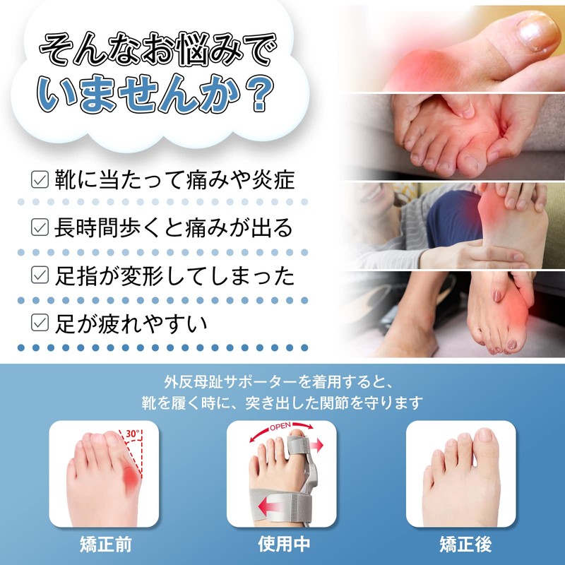 足指グッズ 親指ストレッチャー 装着簡単 自宅用 洗える 防臭 男女兼用 左右兼用(Upgrades （一個セット）)