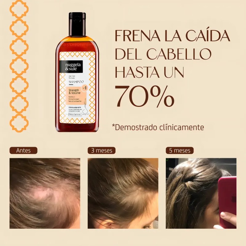 Shampoo Nuggela & Sulé Champú de Cebolla Tratamiento Capilar N°1