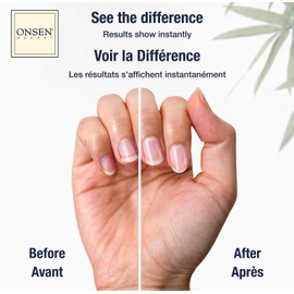 Onsen Onsen Cuticle Cream, Cuticle Oil in Deep Action - Japanese Natural Healing Minerals Nail Care Serum and Butter, Soothe, and Strengthen Cuticles and Nails, Visible Results, Non-Greasy - 30ml