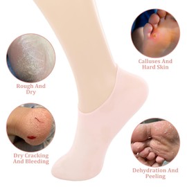 3pcs Silicone Socks for Women Moisturizing Feet, 2pcs Silicone Gloves for Dry Hands Exfoliates and Nourishes The Skin Good Elasticity and Can Be Stretched (Pink)