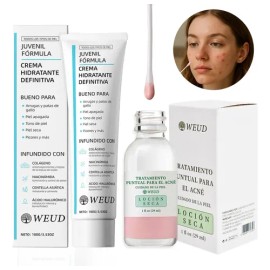 Antiacné Clean Sebum Care Loción Secante Crema Hidratante