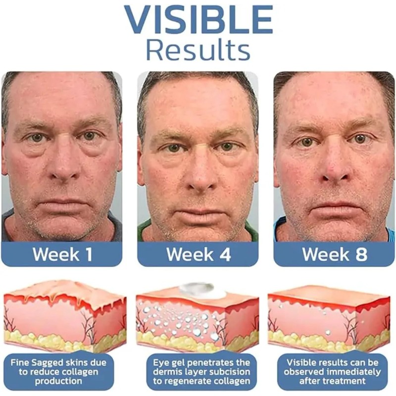 Em Crema Para Ojos Para Hombre Quita Ojeras Arrugas, Retinol