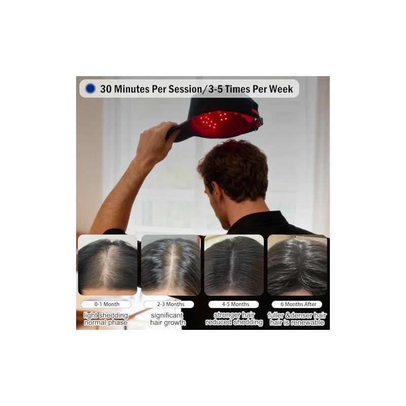 Gorro láser para el crecimiento del cabello, gorro de terapia