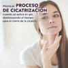 Hebbe - Alantoína Pura, Cicatrizante y Suavizante para Piel Irritada