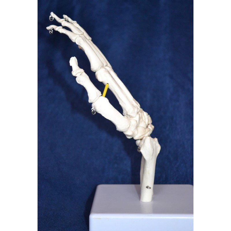Wellden Cranstein A-324 Hand Skeleton Anatomy Model