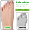 5 Pcs Latex Toe Stretch Bands with Storage Bag, Hallux