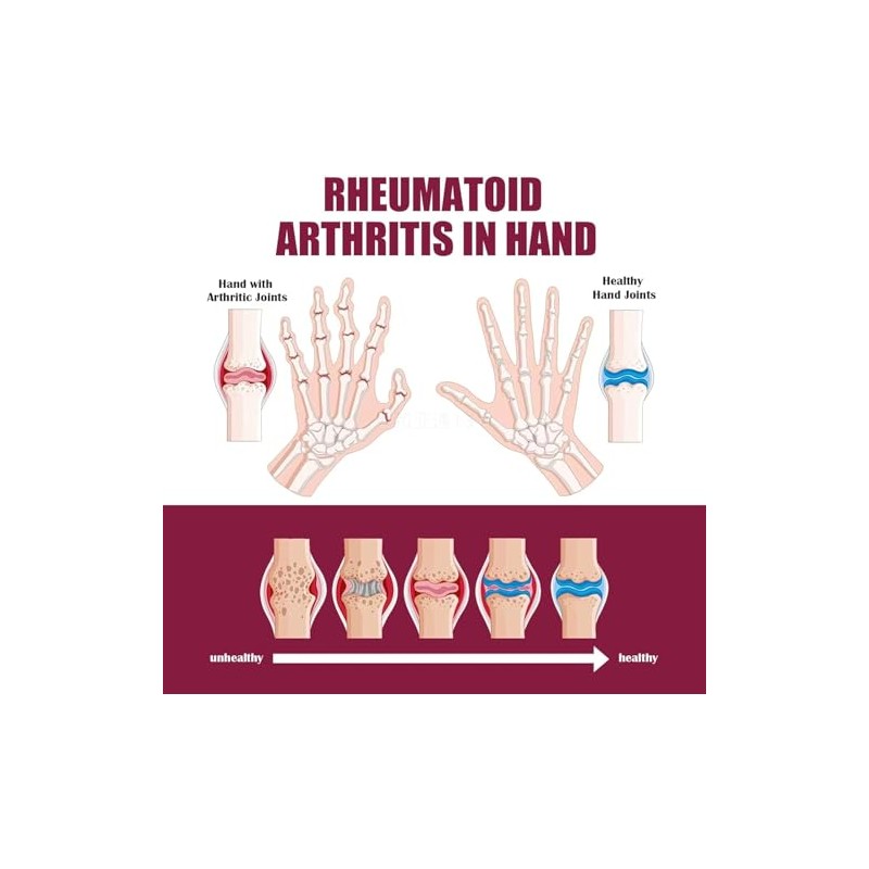 Surllow 3PCS Perfectx Joint & Bone Cream, Perfectx Cream