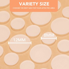 Spot Pimple Patches Aliobio Invisible Blemish Spot Cover Facial Sticker Hydrocolloid Patch Acne Stickers Spot Stickers with Two Sizes 12mm, 8mm (216 Count, 6 Sheets)…, orange, 216 Count (Pack of 1)