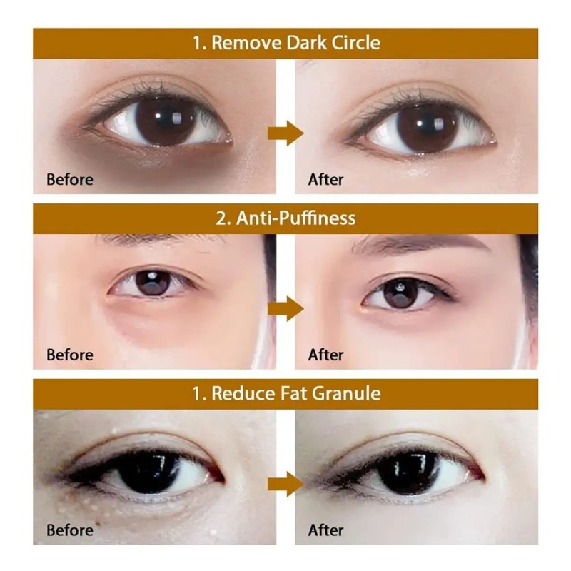 Parches Ojos Hydrogel Contorno Ojos Acido Hialurónico