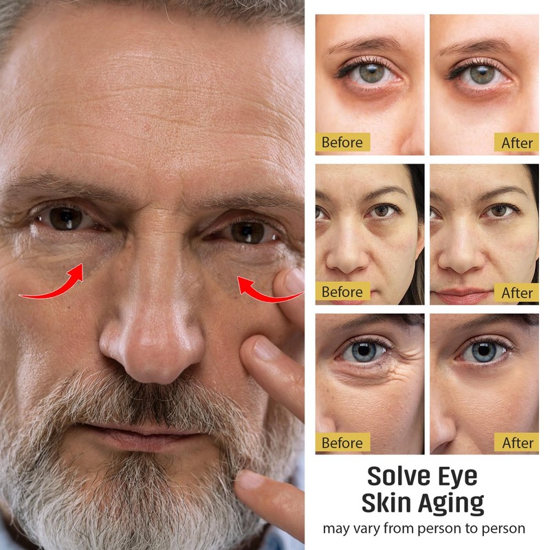 UOG (United One) Eye Serum Complex – Rapid Reduction Eye