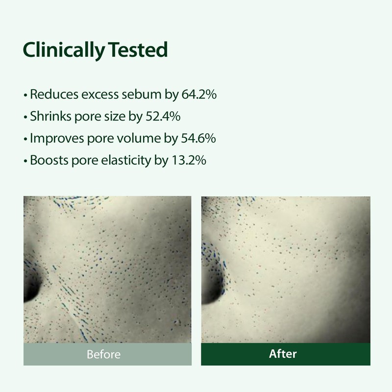 BLITHE Targeted Pore Serum with 22% Niacinamide for Oil Control,