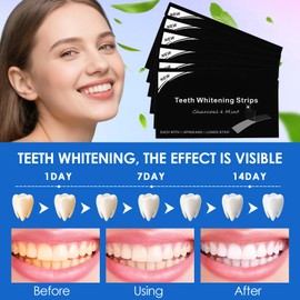14 Strips Zahnaufhellung Bleaching Streifen,Zahnaufhellung Whitening Strips,Teeth Whitening Kit für Zuhause,Zahnverfärbungen entfernen & aufhellen