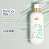 Dove Body Wash Acne Clears & Helps Prevent Acne Tratamiento