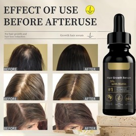 Advanced Hair Growth Serum & Hair Oil for Dry Damaged Hair,Natural Hair Growth Oil,Hair Regrowth Treatment for Men & Women,Stimulates Hair Gr/owth & Controls Ha/ir Fall,Nourishing and Smoothing