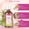 Reductor Del Crecimiento Del Vello Corporal Cyperus Oil 2