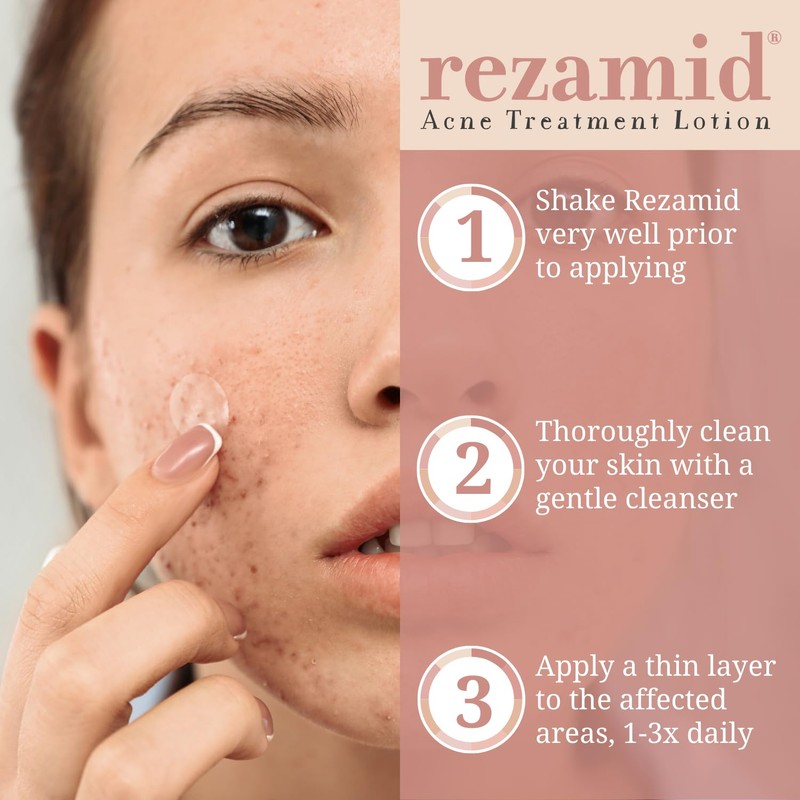 Rezamid Acne Spot Treatment Lotion For Pimples - Skin Clearing