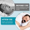 30pcs Cintas bucales para dormir,Reduce la sequedad bucal Parches para